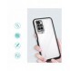 Genomskinligt 3-i-1 fodral för Xiaomi Redmi 10 Frame Gel Cover Svart